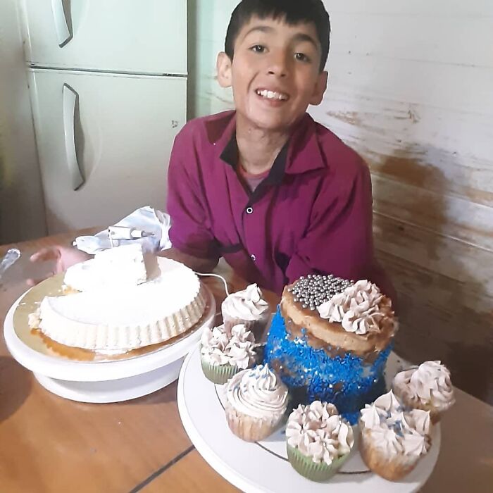 In Argentina, A 10-Year-Old Boy Works As A Confectioner To Pay For His Reconstruction Surgery