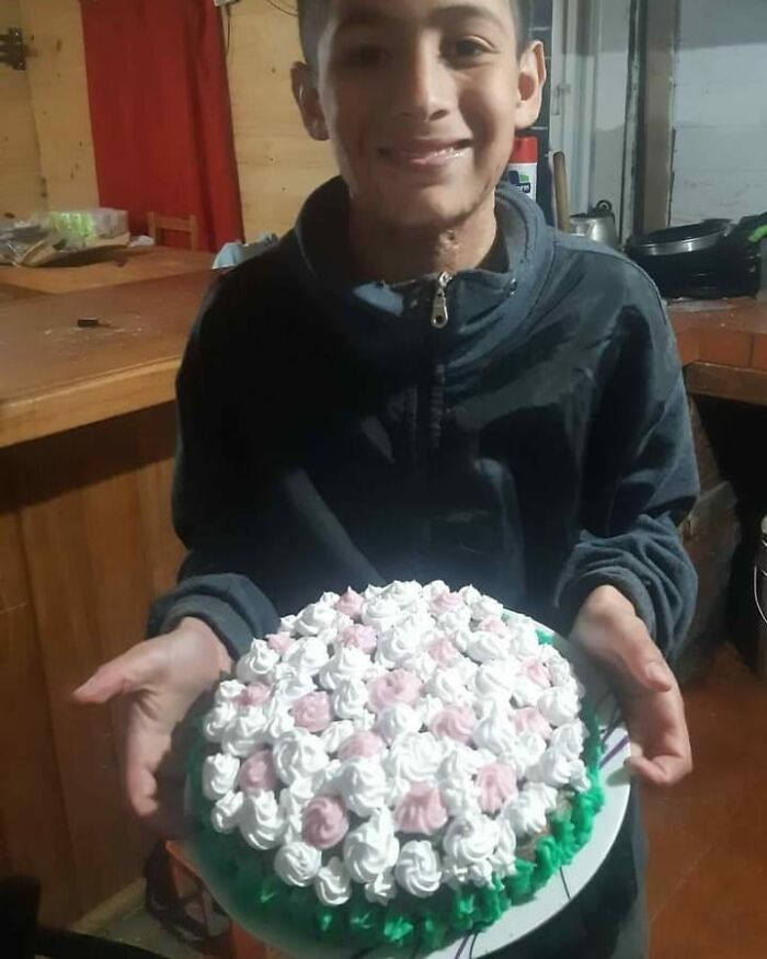 In Argentina, A 10-Year-Old Boy Works As A Confectioner To Pay For His Reconstruction Surgery