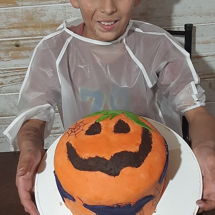 In Argentina, A 10-Year-Old Boy Works As A Confectioner To Pay For His Reconstruction Surgery