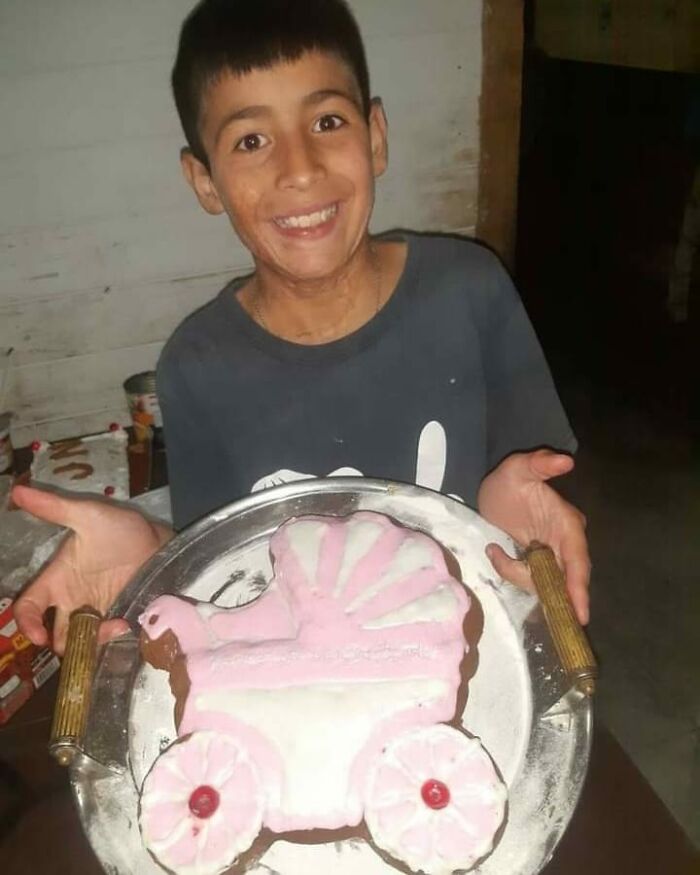 In Argentina, A 10-Year-Old Boy Works As A Confectioner To Pay For His Reconstruction Surgery