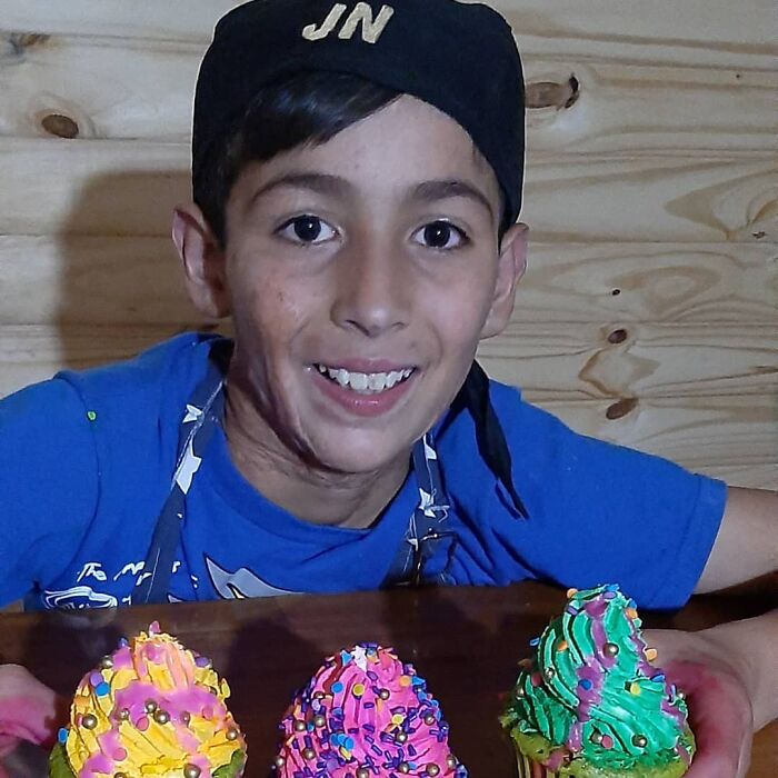 In Argentina, A 10-Year-Old Boy Works As A Confectioner To Pay For His Reconstruction Surgery