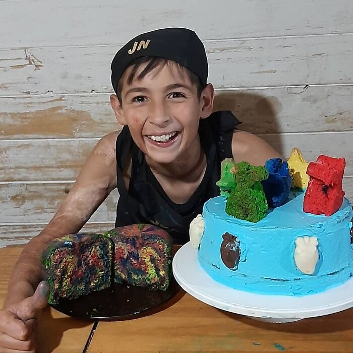 In Argentina, A 10-Year-Old Boy Works As A Confectioner To Pay For His Reconstruction Surgery