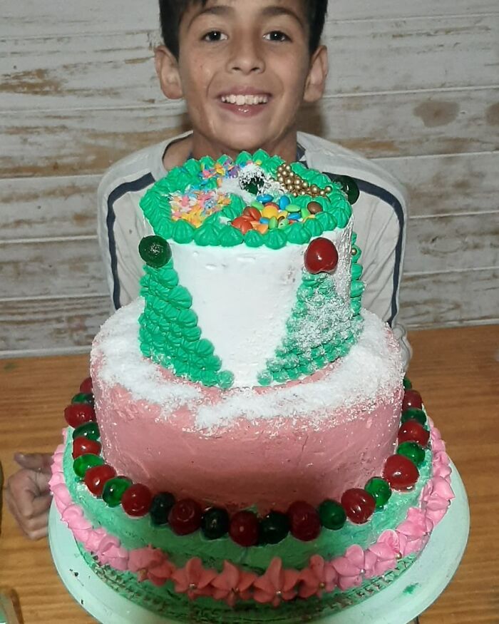 In Argentina, A 10-Year-Old Boy Works As A Confectioner To Pay For His Reconstruction Surgery