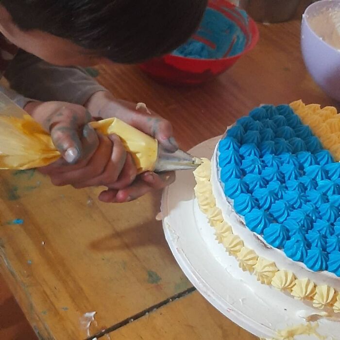 In Argentina, A 10-Year-Old Boy Works As A Confectioner To Pay For His Reconstruction Surgery