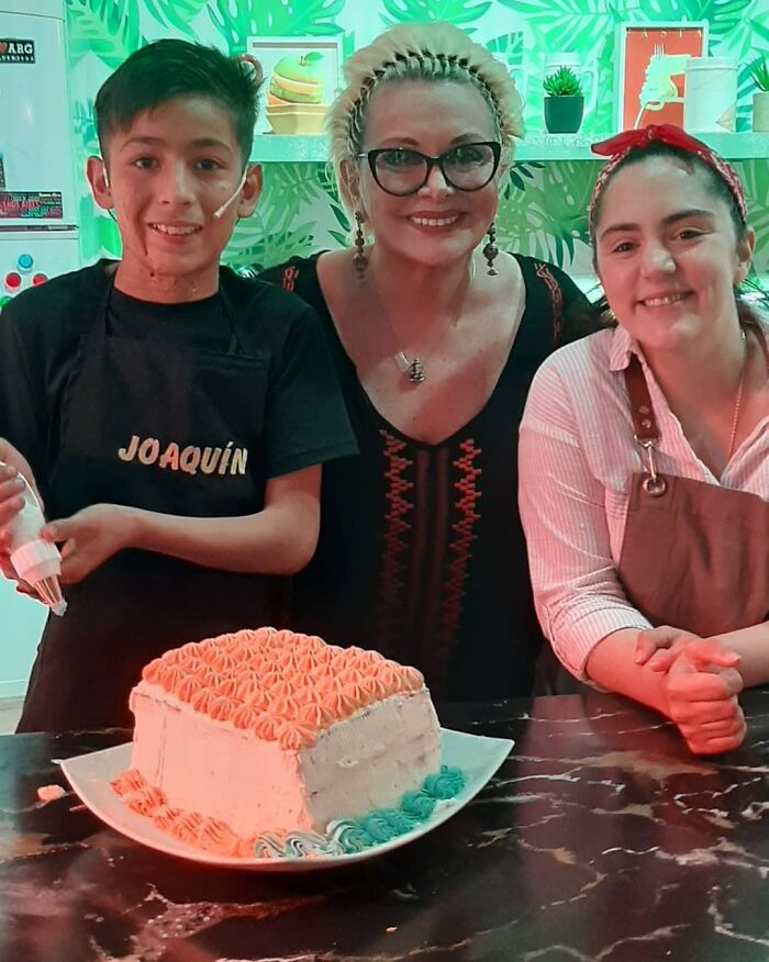 In Argentina, A 10-Year-Old Boy Works As A Confectioner To Pay For His Reconstruction Surgery