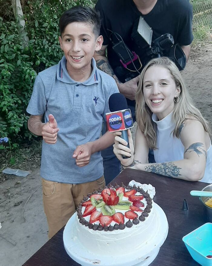 In Argentina, A 10-Year-Old Boy Works As A Confectioner To Pay For His Reconstruction Surgery