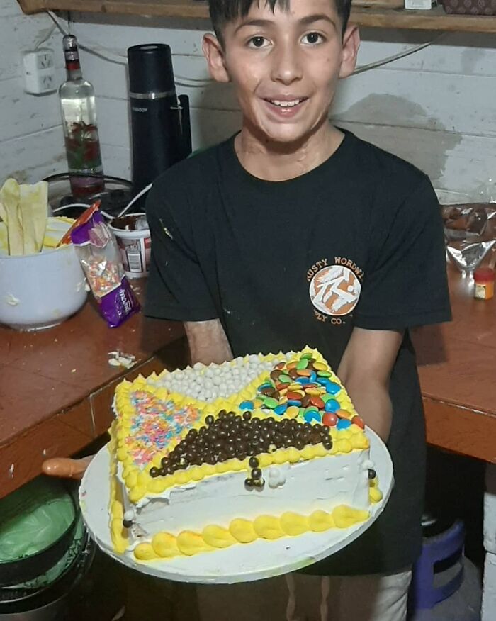 In Argentina, A 10-Year-Old Boy Works As A Confectioner To Pay For His Reconstruction Surgery