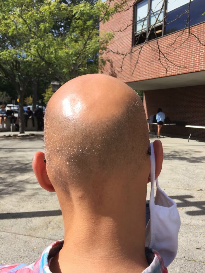 Bald Boi