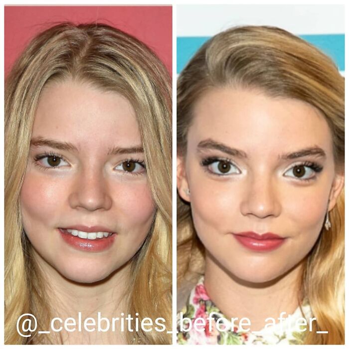 Anya Taylor-Joy
