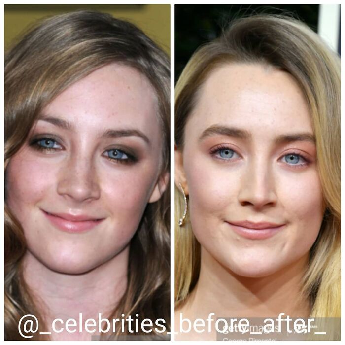 Saoirse Ronan