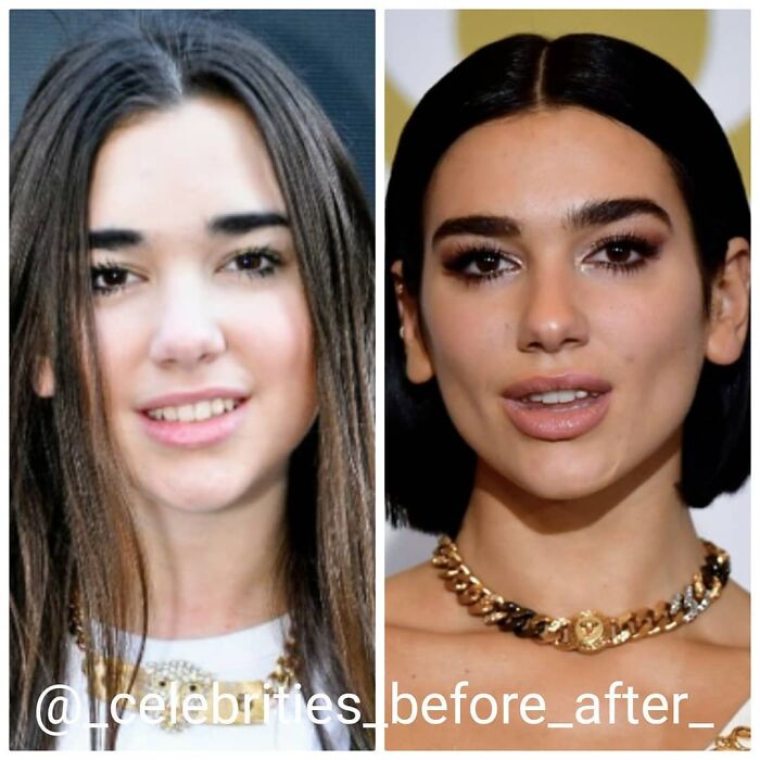 Dua Lipa