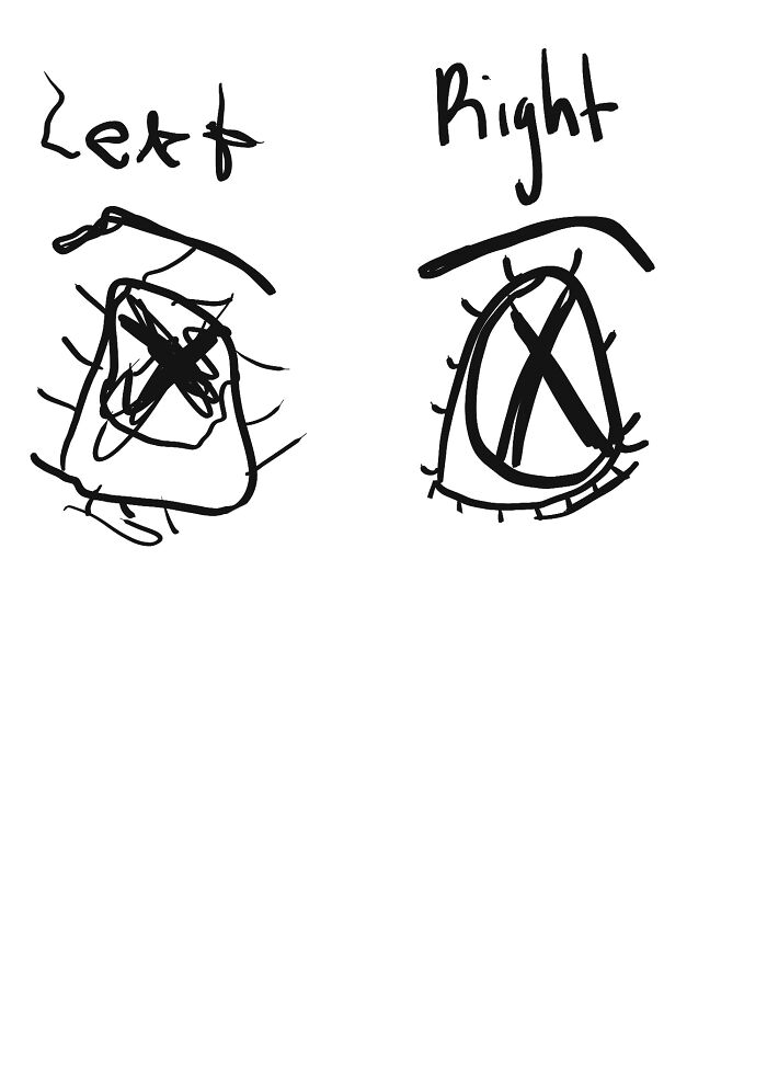 I'm Right-Hand Dominant, In Case You Couldn't Tell.