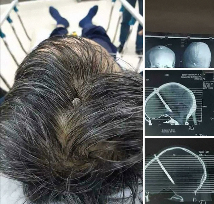 And That’s Why You Wear A Hard Hat