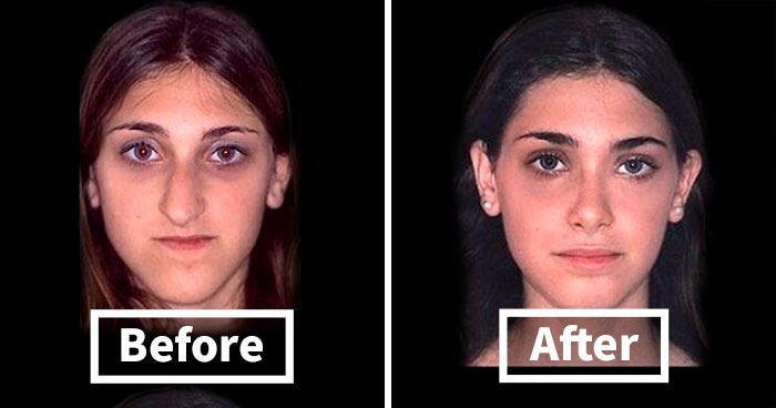 50 Amazing Medical Cases That Are Interesting And Bizarre At The Same Time