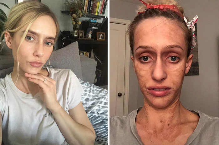 Tried The Hanacure Mask