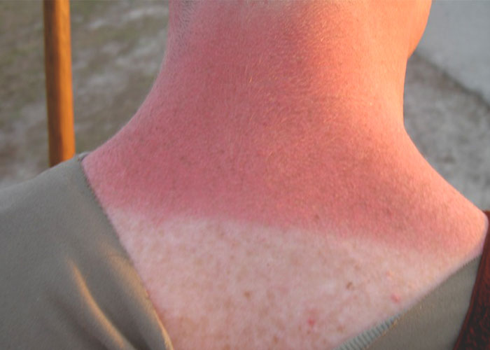 20 Hechos "nada divertidos" aprendidos por la gente y que son tan fascinantes como aterradores