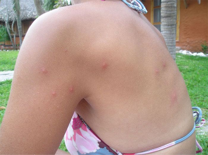 Someone In This Online Group Asked “What Do You Have Too Much Of?” And 30 Folks Delivered