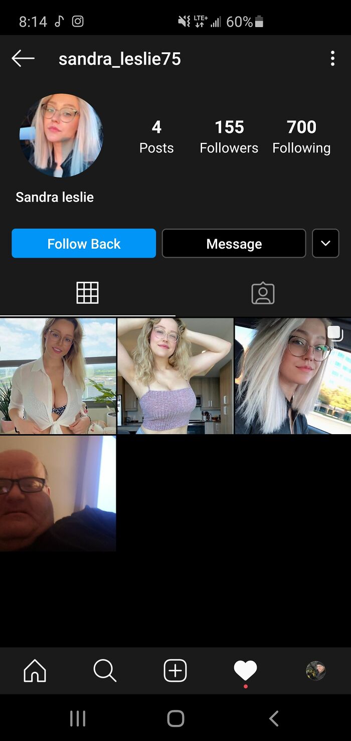 This Neckbeard Used One Cheap Trick To Change His Body. Doctors Hate Him!