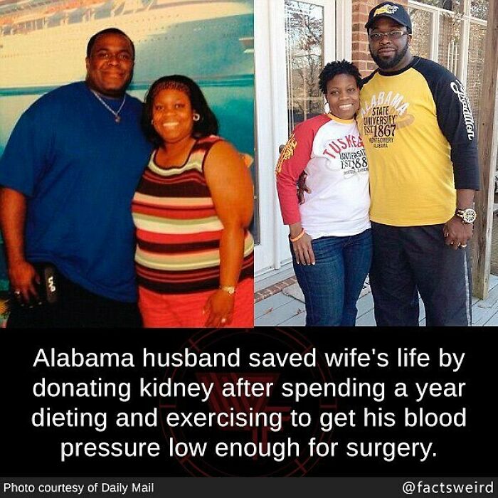 Before and after photos of a couple showing transformation related to weird facts about the world and life-saving donor stories.
