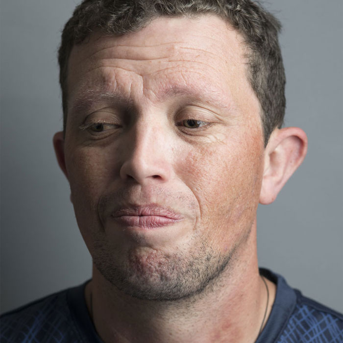 Faces And Stories Of People With Mental Or Physical Illnesses: 16 Portraits I Took