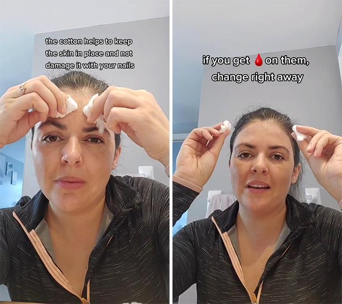 Taking Care Of Your Acne