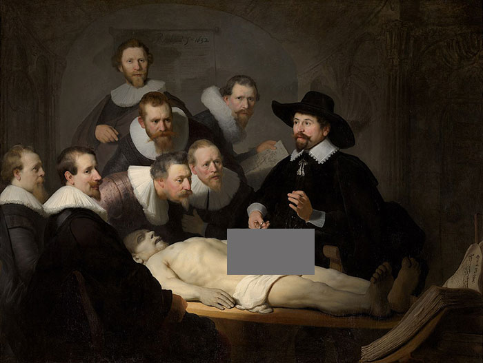 A famous painting depicting a group of men observing an anatomy lesson.