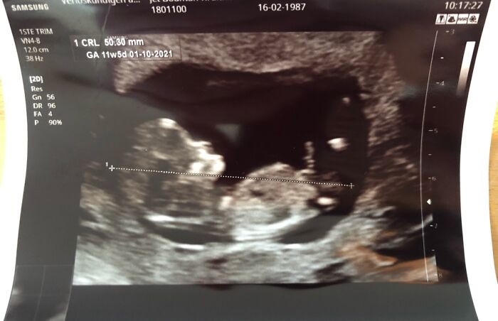 Also One Of The Most Expensive Ones