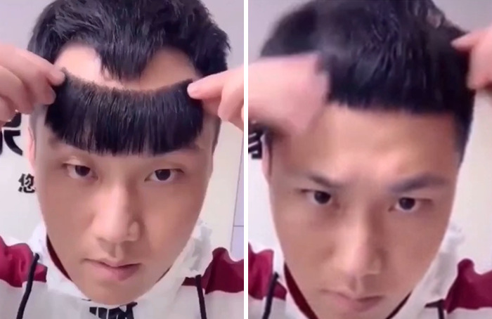 Hairline Looking Fine!