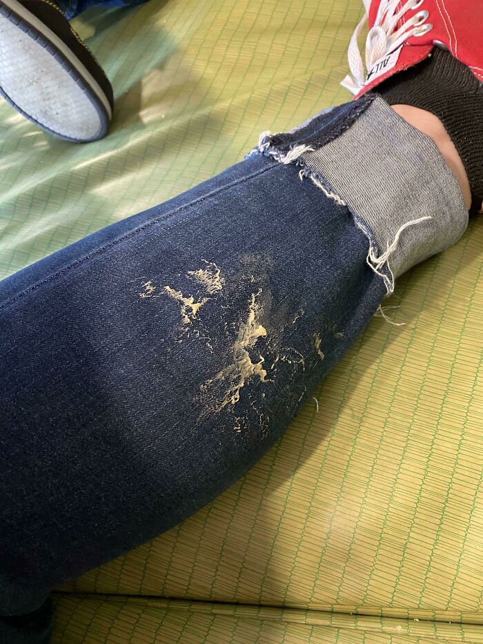 Someone Decided A Great Place To Stick Their Used Gum Was On The Front Of The Bench At A Restaurant. I Was The Lucky Lady That Got To Find It