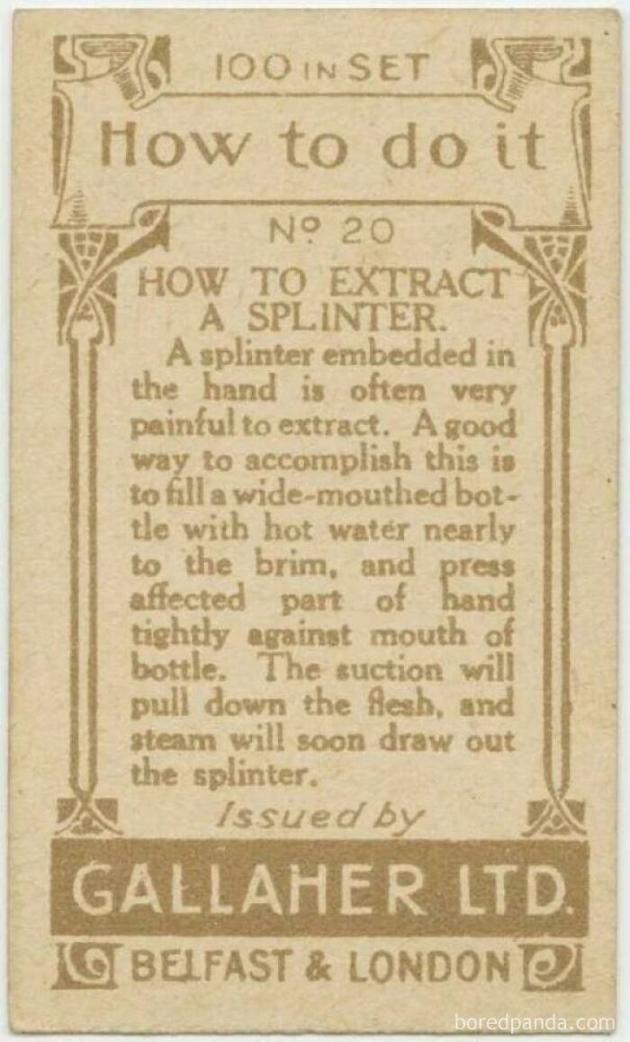 How To Extract A Splinter