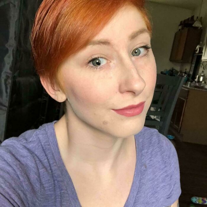 I Have A Pear Shaped Pupil!