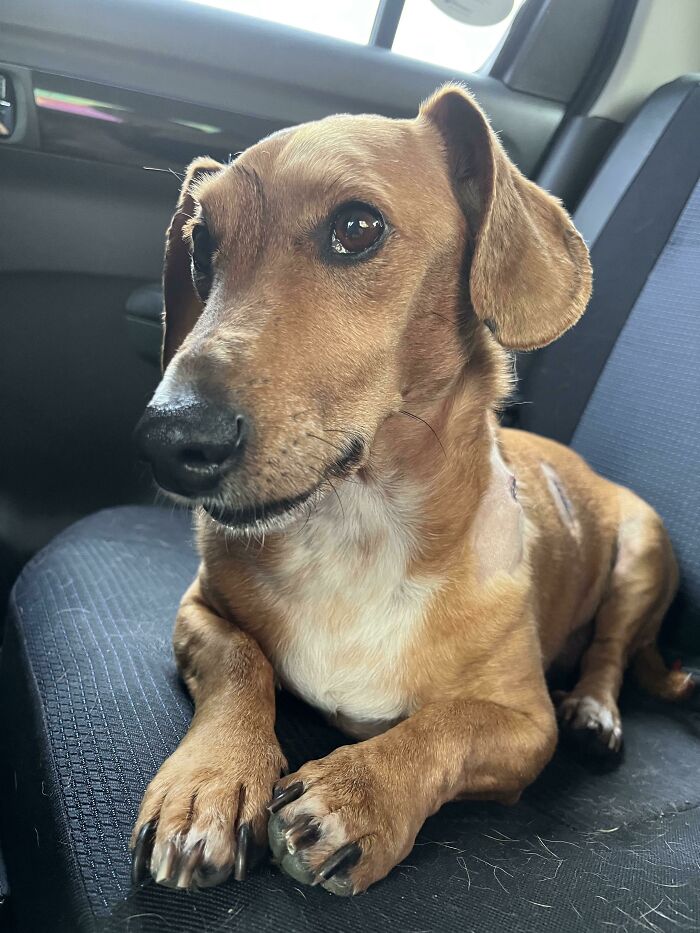 My Boy Just Had A Successful Surgery And Is Now Cancer Free