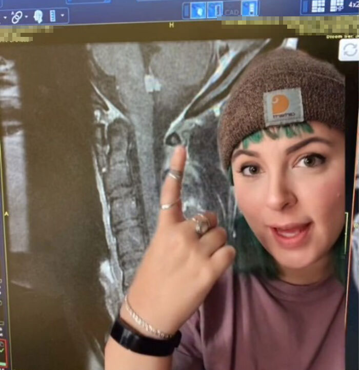 Woman With Brain Tumor Scared And Heartbroken Over The Fact She Can't Get It Removed Because Of Unvaccinated People Woman With Brain Tumor Scared And Heartbroken Over The Fact She Can't Get It Removed Because Of Unvaccinated People