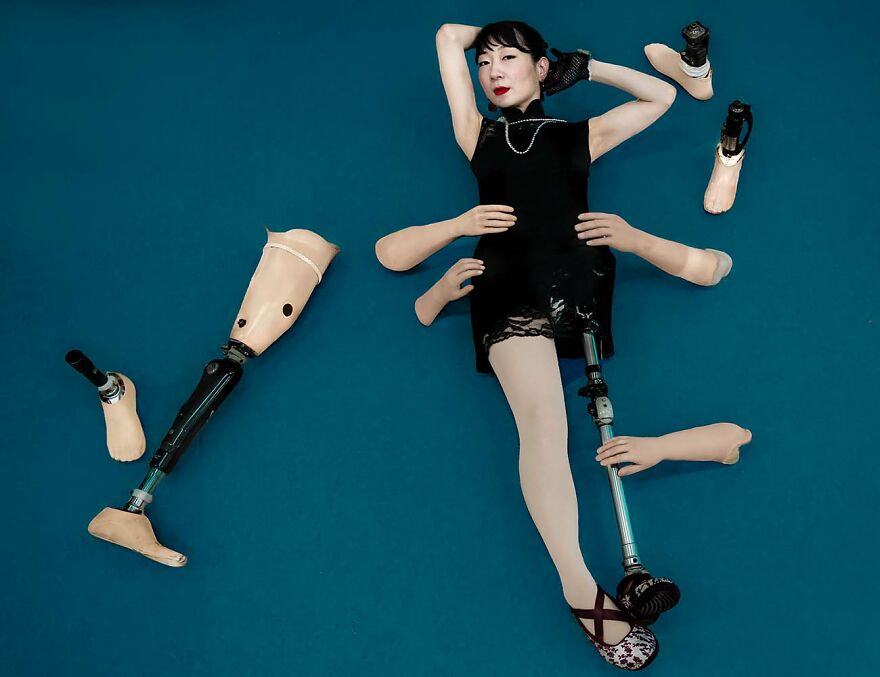 Woman with prosthetic limbs in a stylish black dress, creatively captured by photographers showcasing beautiful women worldwide.