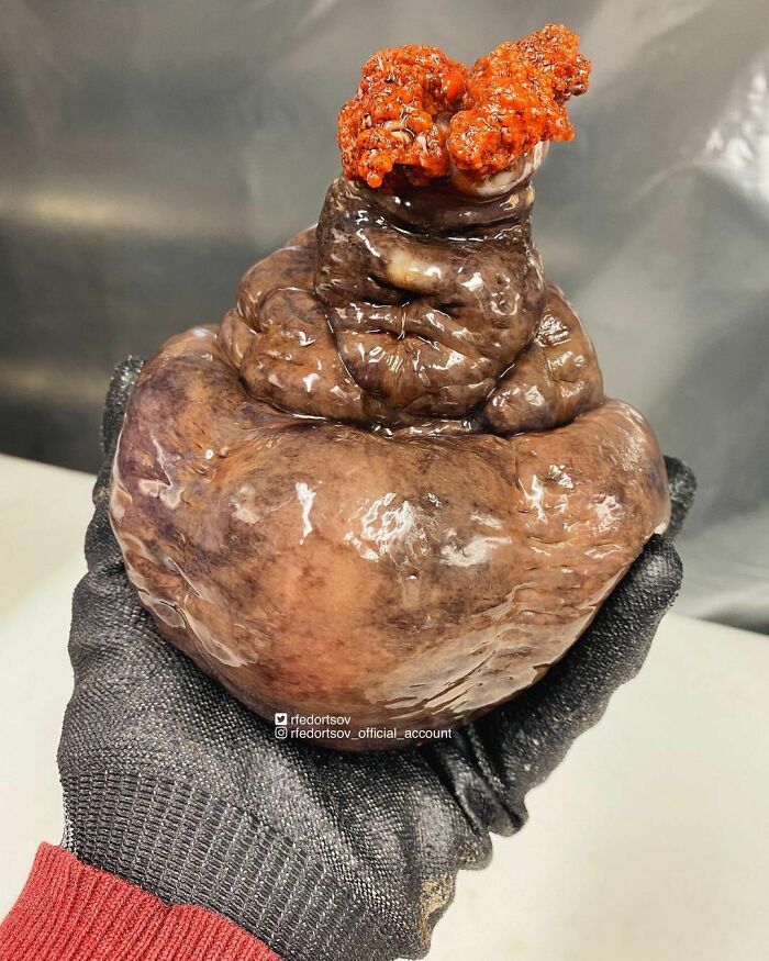 "Hmmm… I See An Unhappy Fat Old Woman With A Bright Hairstyle"