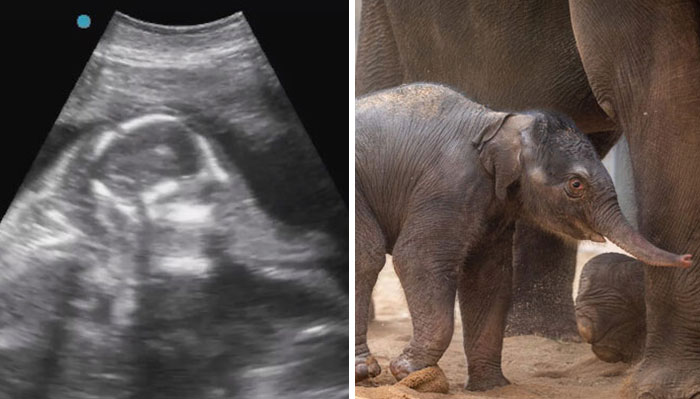 Oklahoma City Zoo Celebrates Birth of Rama The Asian Elephant, Who Got Famous With His Ultrasound Even Before He Was Born