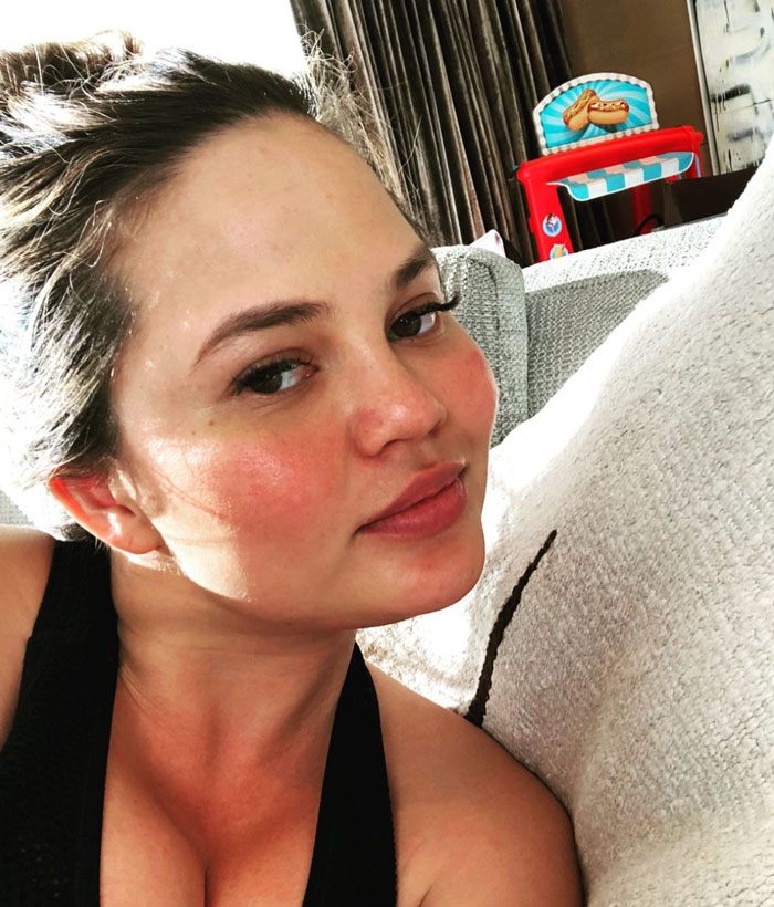 Chrissy Teigen