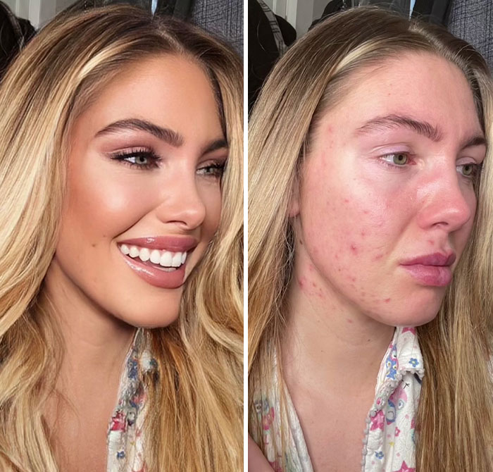 TikToker Goes Viral By Exposing The Truth Behind Heavily-Edited Pictures On Social Media (30 Pics)