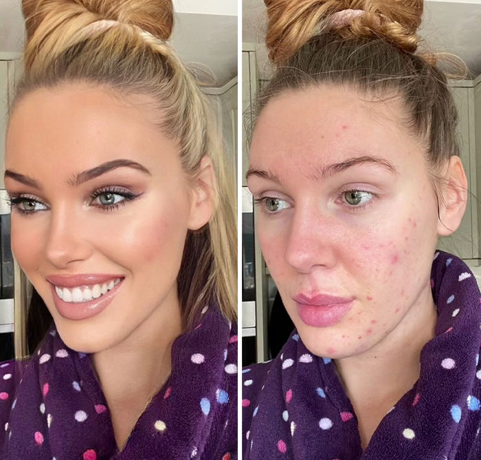 TikToker Goes Viral By Exposing The Truth Behind Heavily-Edited Pictures On Social Media (30 Pics)