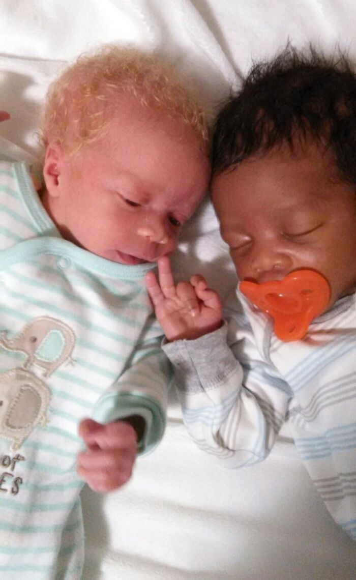 Woman Gave Birth To Black And White Twins, Thought She Was Handed The Wrong Baby Woman Gave Birth To Black And White Twins, Thought She Was Handed The Wrong Baby