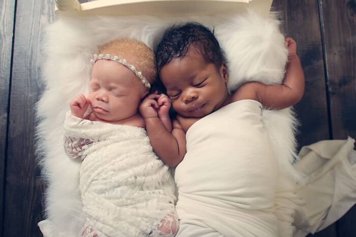 Woman Gave Birth To Black And White Twins, Thought She Was Handed The Wrong Baby Woman Gave Birth To Black And White Twins, Thought She Was Handed The Wrong Baby