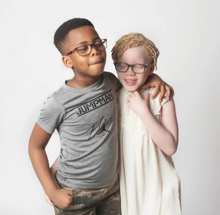 Woman Gave Birth To Black And White Twins, Thought She Was Handed The Wrong Baby Woman Gave Birth To Black And White Twins, Thought She Was Handed The Wrong Baby