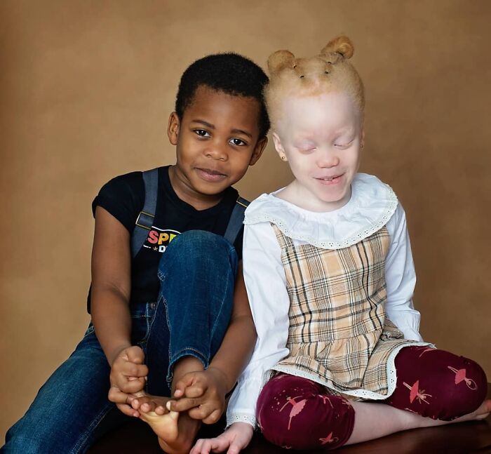 Woman Gave Birth To Black And White Twins, Thought She Was Handed The Wrong Baby Woman Gave Birth To Black And White Twins, Thought She Was Handed The Wrong Baby