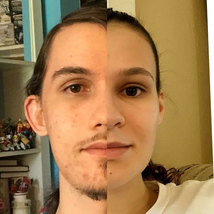 I’ve Been Seeing A Lot Of Twin Posts, So Here’s Me And My (Fraternal) Twin