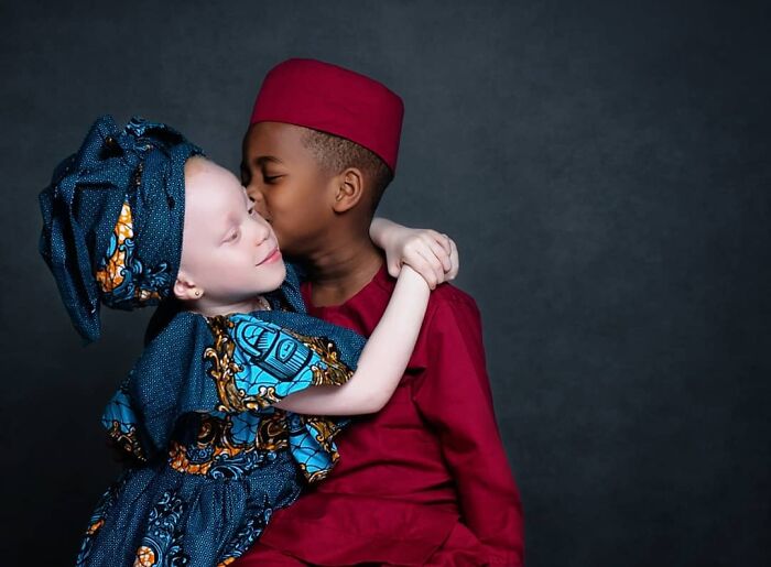 Woman Gave Birth To Black And White Twins, Thought She Was Handed The Wrong Baby Woman Gave Birth To Black And White Twins, Thought She Was Handed The Wrong Baby