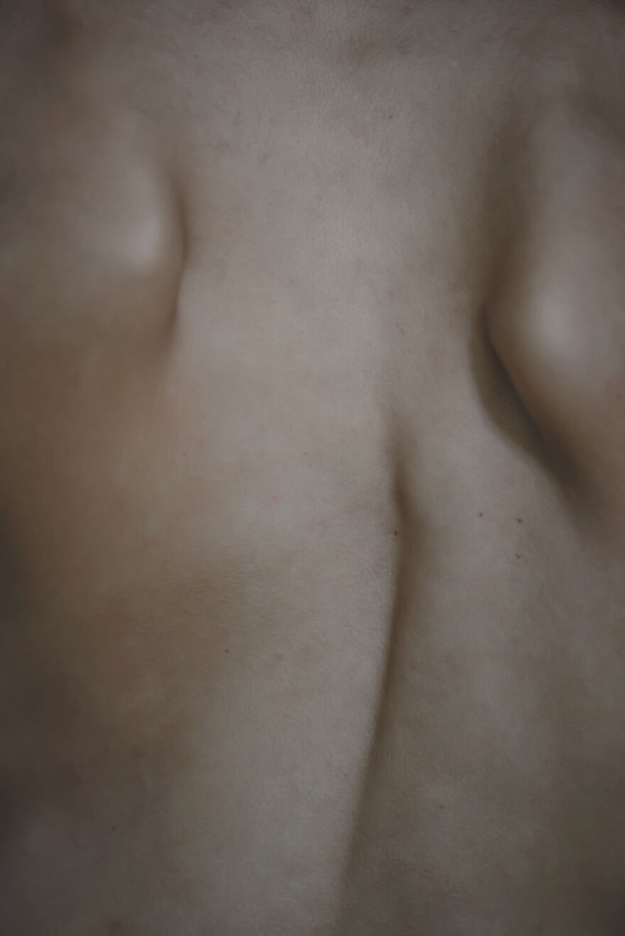 Ms. Spine – We (Me As A Photographer And Simona As A Model) Created A World Of The Spine By Personifying It, In Order To Show The Individual Beauty Of Each Of Us (15 Pics)
