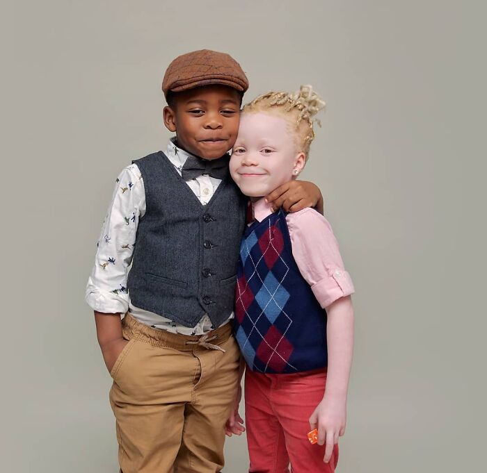 Woman Gave Birth To Black And White Twins, Thought She Was Handed The Wrong Baby Woman Gave Birth To Black And White Twins, Thought She Was Handed The Wrong Baby