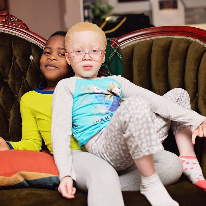 Woman Gave Birth To Black And White Twins, Thought She Was Handed The Wrong Baby Woman Gave Birth To Black And White Twins, Thought She Was Handed The Wrong Baby