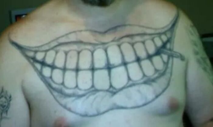 I Guess That’s The Cheaper Option To Gynecomastia Surgery. Definitely Takes The Eyes Away From Those Moobs