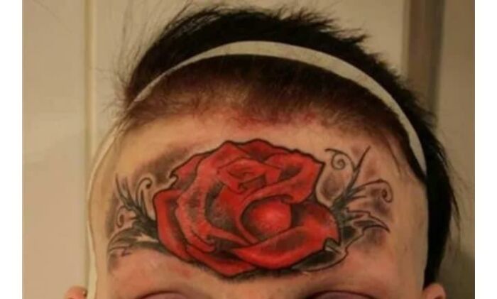 At Least It Detracts From The Fact She Has No Eyebrows